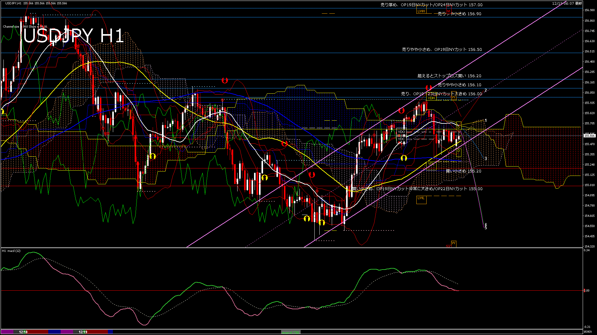 usdjpy60_20251219_090000-gif