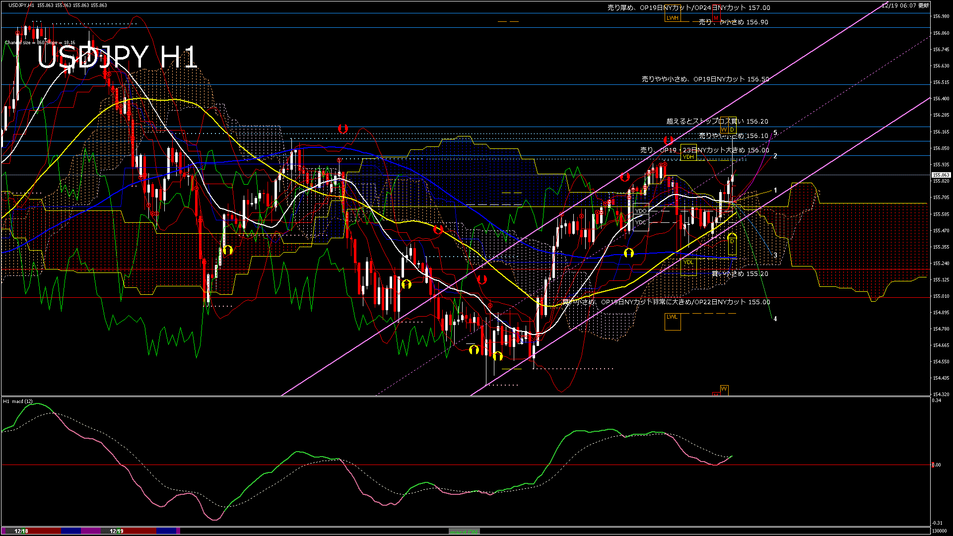 usdjpy60_20251219_130000-gif